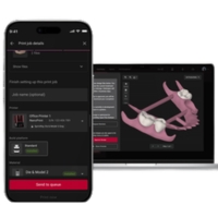 SprintRay NanoPrint - Software conectado y seguimiento de las impresiones
