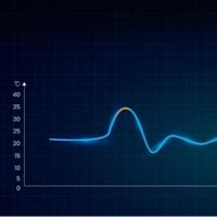 Tecnología Revopoint Trackit
