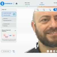 MetiSmile alineación automática